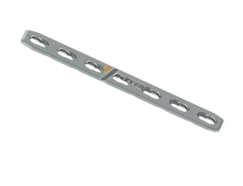 locking plate system