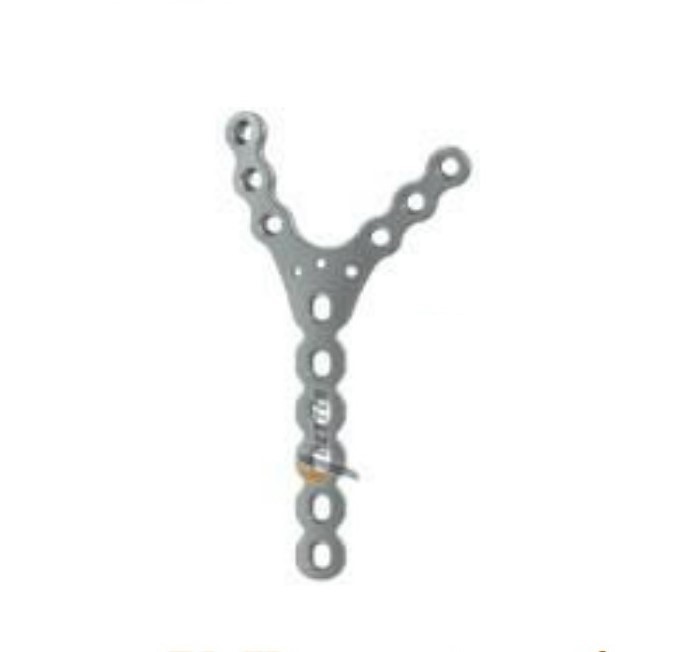 locking plate system